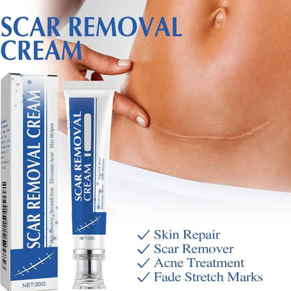 Advanced Scar Gel and Scar Removal Cream