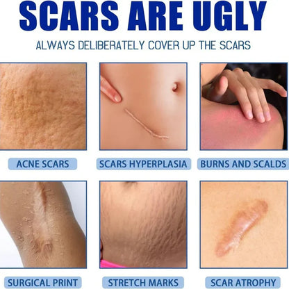 Advanced Scar Gel and Scar Removal Cream